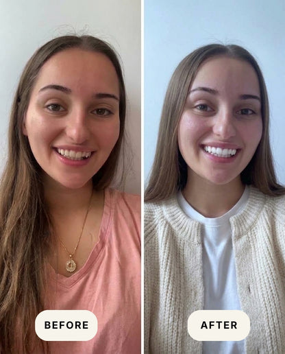 Trüwak™ — Ancient Whitening. No Chemicals, No Pain.